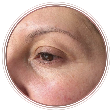 after-signify-nature