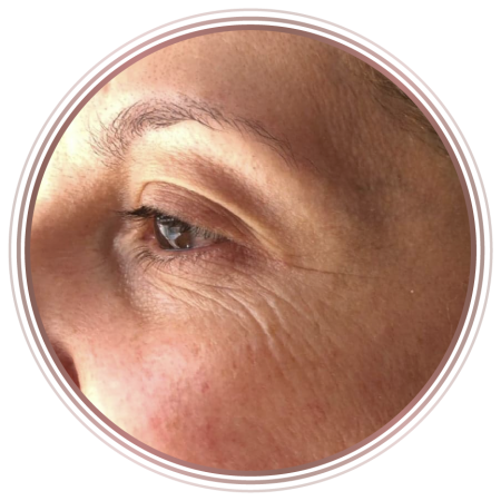 before-signify-nature